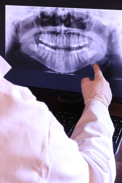 Best Broken or Chipped Tooth Repair in Union Springs, NY